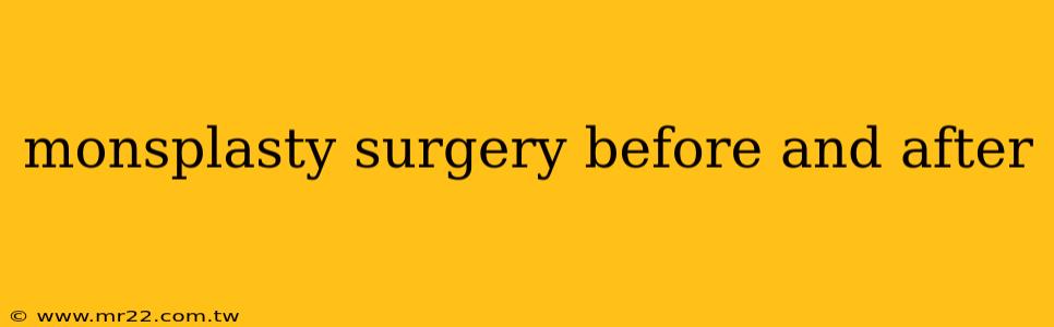 monsplasty surgery before and after