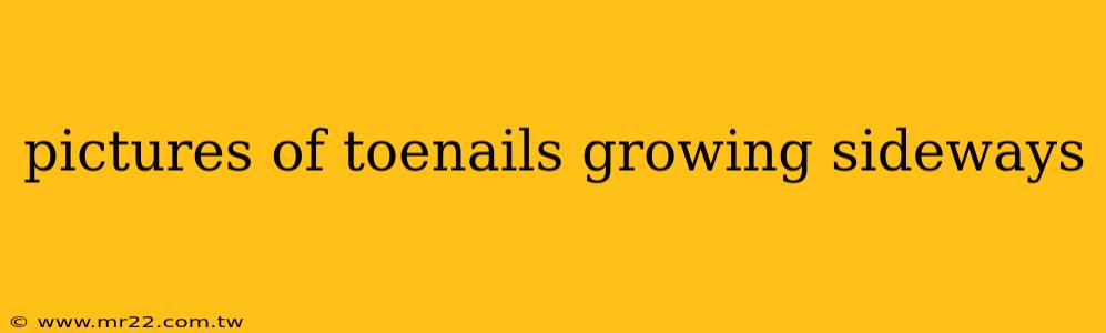 pictures of toenails growing sideways