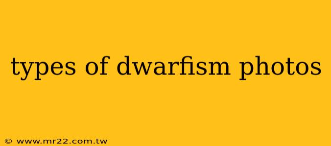 types of dwarfism photos