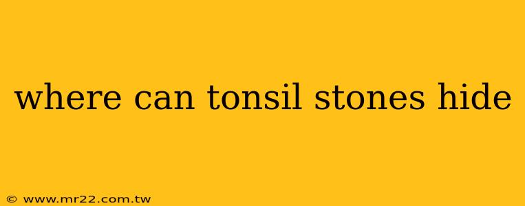 where can tonsil stones hide